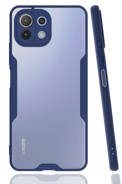 Newface Xiaomi Mİ 11 Lite Kılıf Platin Silikon - Lacivert resmi